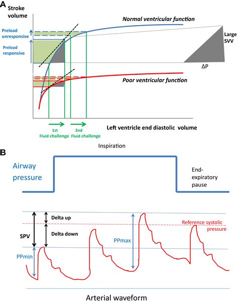 lv kissing|Assessing dynamic fluid.